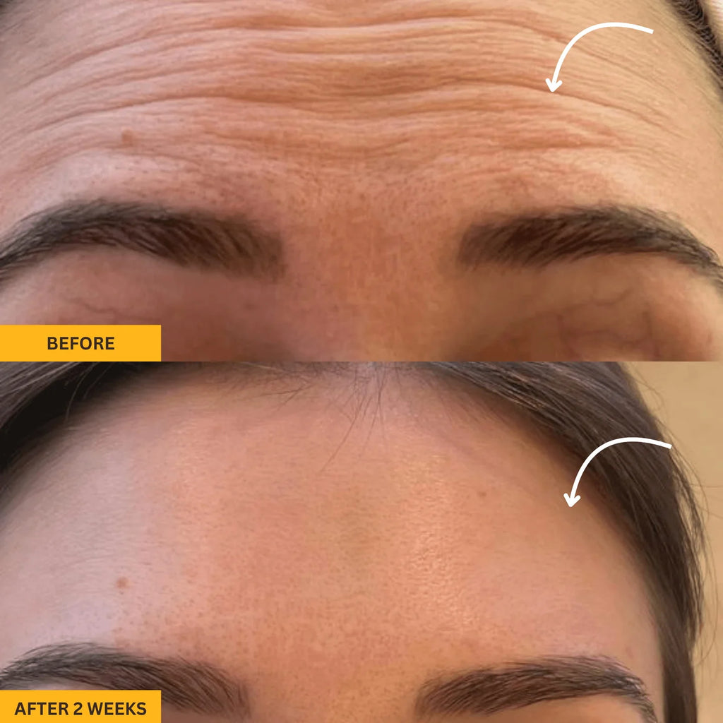 Ureazystore™ Lymphatic Contour Brush