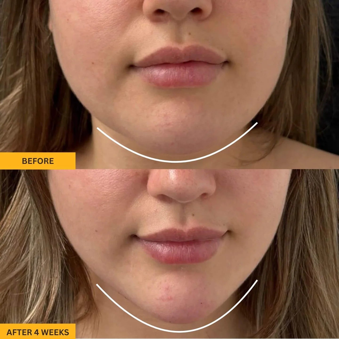 Ureazystore™ Lymphatic Contour Brush