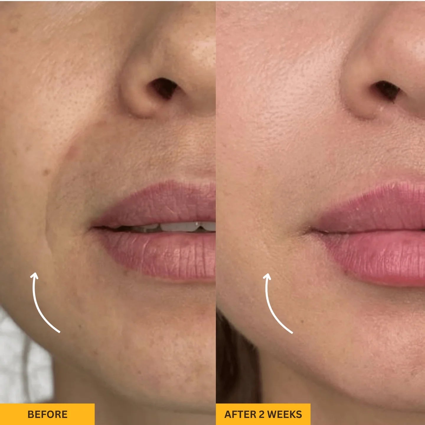 Ureazystore™ Lymphatic Contour Brush